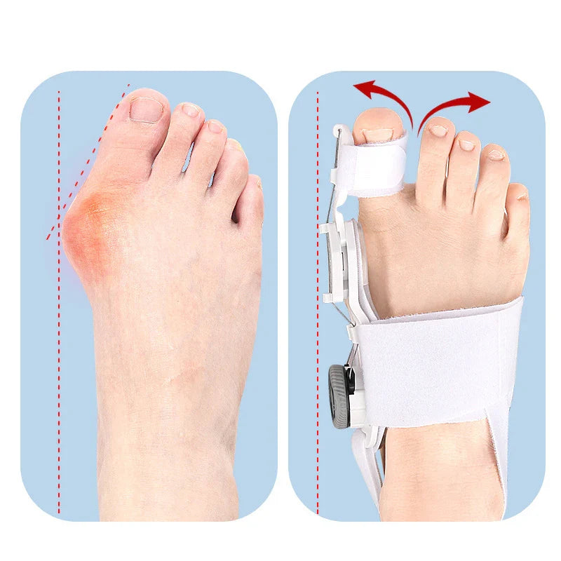 Comfort Toe Aligner for Women